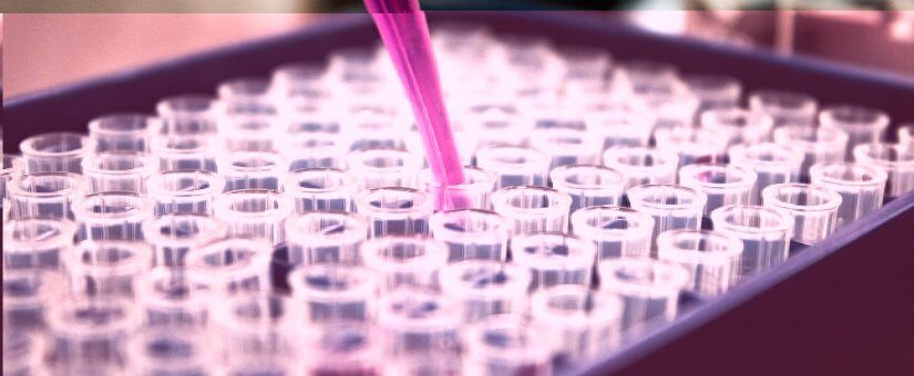 Αταξία Φρίντριχ: Επιστήμονες δημιουργούν μικρά οργανοειδή – αντίγραφα οργάνων για δοκιμή θεραπειών